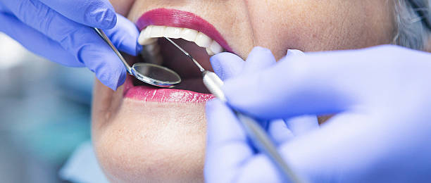 Best Emergency Treatment for Toothache in Soh Salt Lake, UT